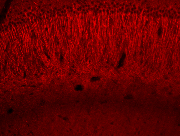 Generously provided by Merlin Levine from National Institutes of Health as part of the Bioss Discovery Program. Mouse brain labeled with Anti-HSP70 Polyclonal Antibody, Unconjugated (bs-0126R) at 1:100 overnight. The secondary antibody was AlexaFluor 555 goat anti mouse IgG1 used at 1:250 for one hour.