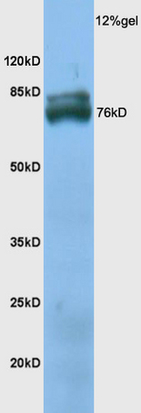 Mouse skeletal muscle lysate probed with Anti TXLNB Polyclonal Antibody, Unconjugated (bs-12153R) at 1:200 overnight at 4˚C. Followed by conjugation to secondary antibody (bs-0295G-HRP) at 1:3000 for 90 min at 37˚C. Predicted band 76kD. Observed band size: 76kD