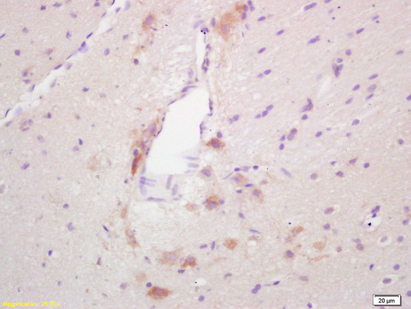 Formalin-fixed and paraffin embedded rat brain labeled with Rabbit Anti GAD65 Polyclonal Antibody, Unconjugated (bs-0400R) at 1:200 followed by conjugation to the secondary antibody and DAB staining