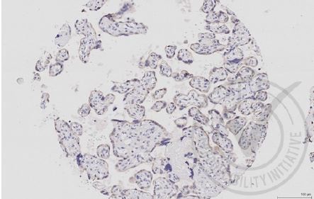 Images provided the Independent Validation Program (badge number 029646)Formalin-fixed and paraffin embedded human placenta labeled with Rabbit Anti-MEK1 Polyclonal Antibody (bs-1433R) at 1:250 overnight at room temperature followed by conjugation to secondary antibody. \n