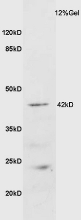 Mouse brain lysate probed with Anti GALR2 Polyclonal Antibody, Unconjugated (bs-11527R) at 1:200 overnight at 4˚C. Followed by conjugation to secondary antibody (bs-0295G-HRP) at 1:3000 for 90 min at 37˚C. Predicted band 42kD. Observed band size: 42kD