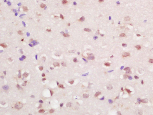 Formalin-fixed and paraffin embedded at brain labeled with Anti-RFX4 Polyclonal Antibody, Unconjugated (bs-11943R) at 1:200 followed by conjugation to the secondary antibody and DAB staining\n