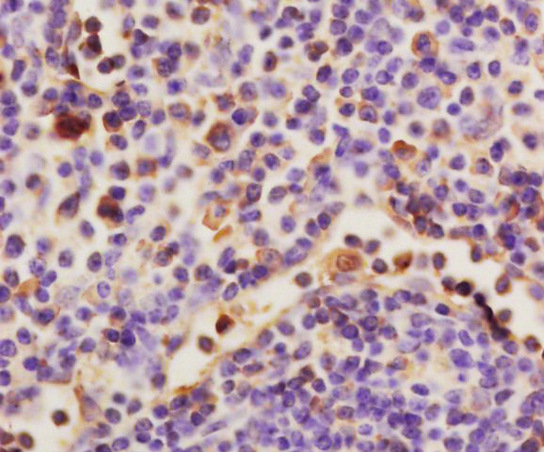 Formalin-fixed and paraffin embedded rat spleen labeled with Anti-HAS1 Polyclonal Antibody, Unconjugated (bs-2946R) at 1:200 followed by conjugation to the secondary antibody and DAB staining\n