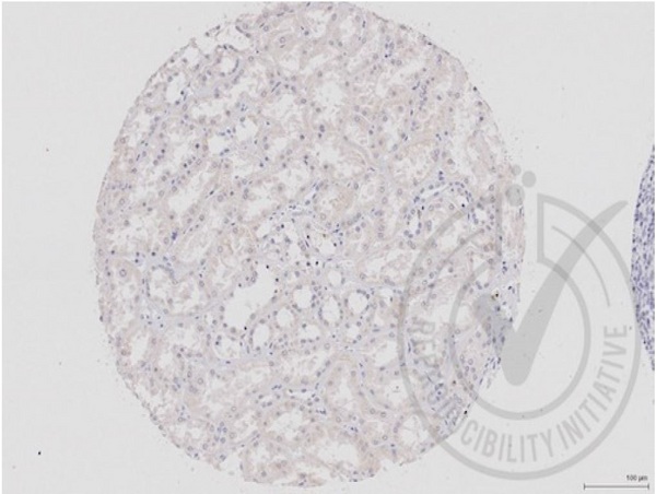 Images provided the Independent Validation Program (badge number 029657)Formalin-fixed and paraffin embedded human kidney labeled with Rabbit Anti-DVL1 Polyclonal Antibody (bs-0598R) at 1:250 overnight at room temperature followed by conjugation to secondary antibody.