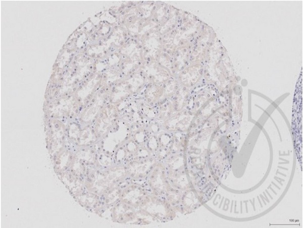 Images provided the Independent Validation Program (badge number 029657)Formalin-fixed and paraffin embedded human kidney labeled with Rabbit Anti-DVL1 Polyclonal Antibody (bs-0598R) at 1:250 overnight at room temperature followed by conjugation to secondary antibody.