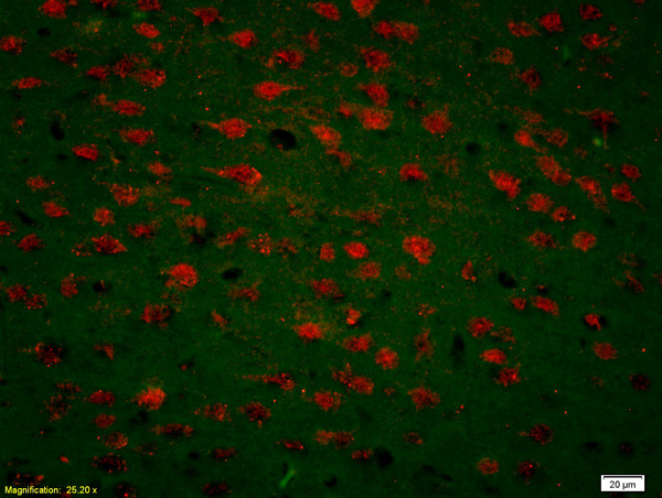 Formalin-fixed and paraffin-embedded rat brain labeled with Anti-CDK5 Polyclonal Antibody, Unconjugated(bs-0559R) 1:200, overnight at 4°C, The secondary antibody was Goat Anti-Rabbit IgG, Cy3 conjugated(bs-0295G-Cy3)used at 1:200 dilution for 40 minutes at 37°C.