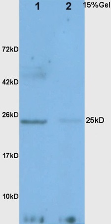 L1 rat liver lysates L2 mouse intestine lysates probed with Anti Adiponectin Polyclonal Antibody, Unconjugated (bs-0471R) at 1:200 overnight at 4˚C. Followed by conjugation to secondary antibody (bs-0295G-HRP) at 1:3000 for 90 min at 37˚C. Predicted band 25kD. Observed band size:25kD.