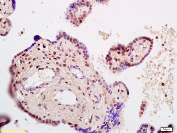 Formalin-fixed and paraffin embedded human placenta labeled with  Rabbit Anti CDKN1C\/p57 Kip2 Polyclonal Antibody, Unconjugated (bs-0538R) at 1:200 followed by conjugation to the secondary antibody and DAB staining