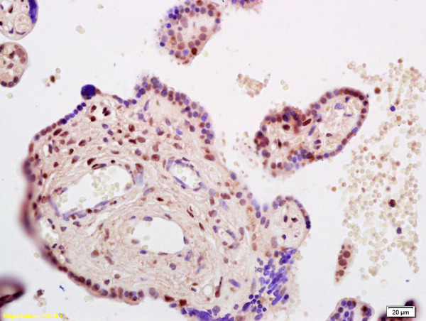 Formalin-fixed and paraffin embedded human placenta labeled with Rabbit Anti CDKN1C/p57 Kip2 Polyclonal Antibody, Unconjugated (bs-0538R) at 1:200 followed by conjugation to the secondary antibody and DAB staining