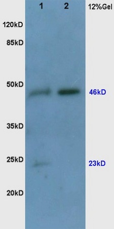 Human colon carcinoma lysates probed with Rabbit Anti-VEGF Polyclonal Antibody (bs-0279R) at 1:200 in 4˚C. Followed by conjugation to secondary antibody (bs-0295G-HRP) at 1:3000 90min in 37˚C. Predicted and observed band size: 23,46kDa