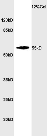 Mouse brain lysate probed with Rabbit Anti-CYP24A1 Polyclonal Antibody (bs-3899R) at 1:200 in 4˚C. Followed by conjugation to secondary antibody (bs-0295G-HRP) at 1:3000 90min in 37˚C. Predicted and observed band size: 55kDa