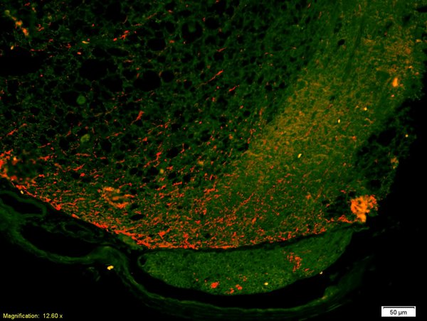 Formalin-fixed and paraffin-embedded injured rat spinal cord labeled with Anti-FPRL1 Polyclonal Antibody, Unconjugated(bs-3654R) 1:200, overnight at 4°C, The secondary antibody was Goat Anti-Rabbit IgG, Alexa Fluor 647 conjugated(bs-0295G-A647)used at 1:200 dilution for 40 minutes at 37°C.