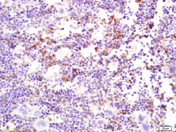 Formalin-fixed and paraffin embedded mouse spleen labeled with  Rabbit Anti C-Mer\/MERTK Polyclonal Antibody, Unconjugated (bs-0548R) at 1:200 followed by conjugation to the secondary antibody and DAB staining