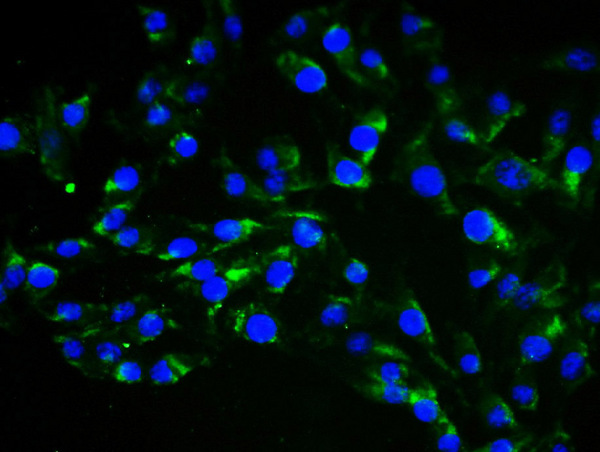 4% Paraformaldehyde-fixed Human Umbilical Artery Endothelial Cells(HUAEC)probed with Anti-Vimentin Polyclonal Antibody, Alexa Fluor 488 conjugated (bs-8533R-A488) 1:100, 60 minutes at 37\u00b0C. DAPI(5ug\/ml,blue) was used to stain the cell nuclei
