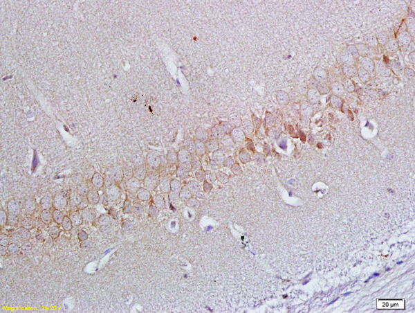 Formalin-fixed and paraffin embedded rat brain labeled with Anti-ApoER2 Polyclonal Antibody, Unconjugated (bs-6651R) at 1:200 followed by conjugation to the secondary antibody and DAB staining Formalin-fixed and paraffin embedded rat brain labeled with Anti-ApoER2 Polyclonal Antibody, Unconjugated (bs-6651R) at 1:200 followed by conjugation to the secondary antibody and DAB staining