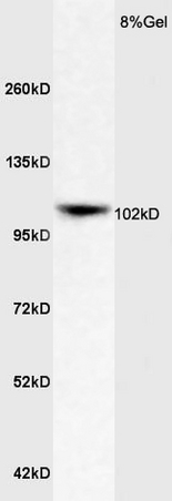 Rat Brain lysates probed with Rabbit Anti-ApoER2 Polyclonal Antibody(bs-6651R) at 1:200 in 4˚C. Followed by conjugation to secondary antibody (bs-0295G-HRP) at 1:3000 90min in 37˚C. Predicted and observed band size: 102kDa Rat Brain lysates probed with Rabbit Anti-ApoER2 Polyclonal Antibody(bs-6651R) at 1:200 in 4˚C. Followed by conjugation to secondary antibody (bs-0295G-HRP) at 1:3000 90min in 37˚C. Predicted and observed band size: 102kDa