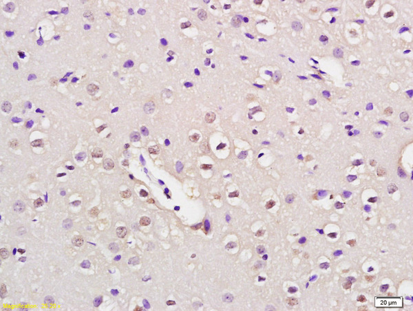 Formalin-fixed and paraffin embedded rat brain labeled with Anti-NUP50 Polyclonal Antibody, Unconjugated (bs-7665R) at 1:200 followed by conjugation to the secondary antibody and DAB staining