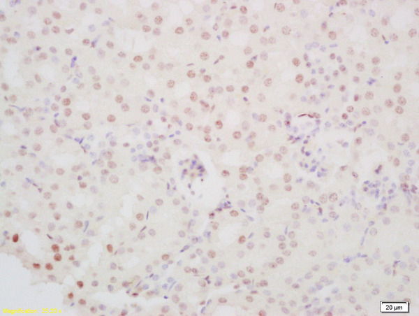 Formalin-fixed and paraffin embedded mouse kidney labeled with Anti-PINX-1 Polyclonal Antibody, Unconjugated (bs-9594R) at 1:200 followed by conjugation to the secondary antibody and DAB staining\n