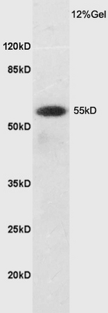 Mouse brain lysates probed with Rabbit Anti-SLC7A5 Polyclonal Antibody (bs-10125R) at 1:200 in 4˚C. Followed by conjugation to secondary antibody (bs-0295G-HRP) at 1:3000 90min in 37˚C. Predicted and observed band size: 55kDa