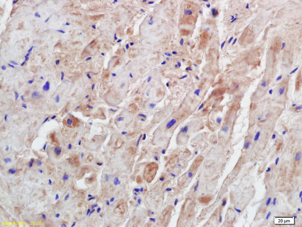 Formalin-fixed and paraffin embedded mouse heart labeled with Anti-Syntrophin-2 Polyclonal Antibody, Unconjugated (bs-10384R) at 1:200 followed by conjugation to the secondary antibody and DAB staining