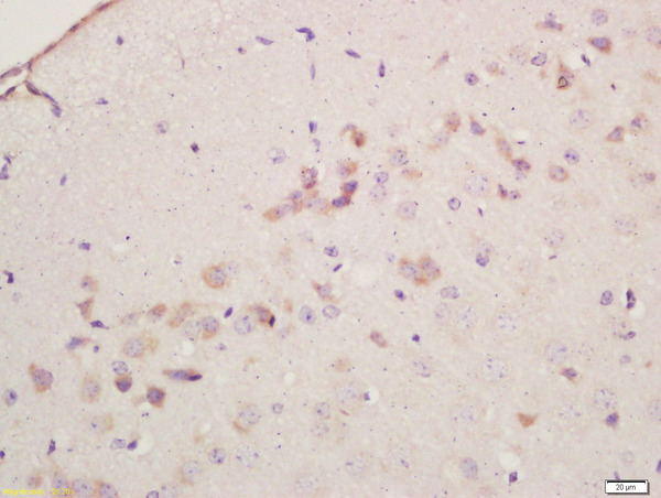 Formalin-fixed and paraffin embedded mouse brain labeled with Anti-Cyclooxygenase-2 Polyclonal Antibody, Unconjugated (bs-10411R) at 1:200 followed by conjugation to the secondary antibody and DAB staining