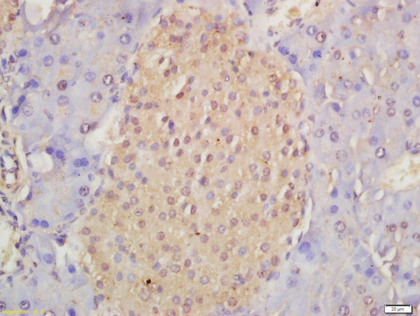Formalin-fixed and paraffin embedded mouse pancreas labeled with Anti-Musashi 1/Msi1 Polyclonal Antibody, Unconjugated (bs-11201R) at 1:200 followed by conjugation to the secondary antibody and DAB staining\n