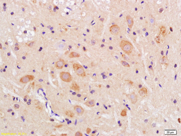 Formalin-fixed and paraffin embedded rat brain labeled with Anti-TMEM158 Polyclonal Antibody, Unconjugated (bs-11770R) at 1:200 followed by conjugation to the secondary antibody and DAB staining