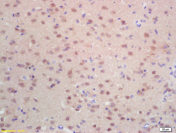 Formalin-fixed and paraffin embedded rat brain labeled with Rabbit Anti Histone H3-like protein Polyclonal Antibody, Unconjugated (bs-0621R) at 1:200 followed by conjugation to the secondary antibody and DAB staining