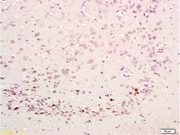 Formalin-fixed and paraffin embedded rat brain labeled with Rabbit Anti-CDK5 Polyclonal Antibody (bs-0559R) at 1:200 followed by conjugation to the secondary antibody and DAB staining.
