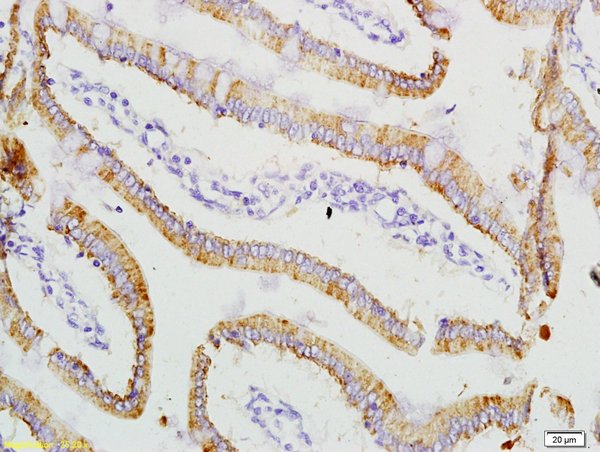 Formalin-fixed and paraffin embedded rat small intestine labeled with Anti-ADM2 Polyclonal Antibody, Unconjugated (bs-2985R) at 1:200 followed by conjugation to the secondary antibody and DAB staining