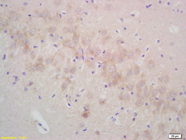 Formalin-fixed and paraffin embedded rat brain labeled with Rabbit Anti gamma Synuclein Polyclonal Antibody, Unconjugated (bs-0622R) at 1:200 followed by conjugation to the secondary antibody and DAB staining