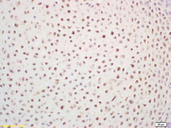 Formalin-fixed and paraffin embedded mouse embryo labeled with Rabbit Anti ZNF268 Polyclonal Antibody, Unconjugated (bs-0626R) at 1:200 followed by conjugation to the secondary antibody and DAB staining