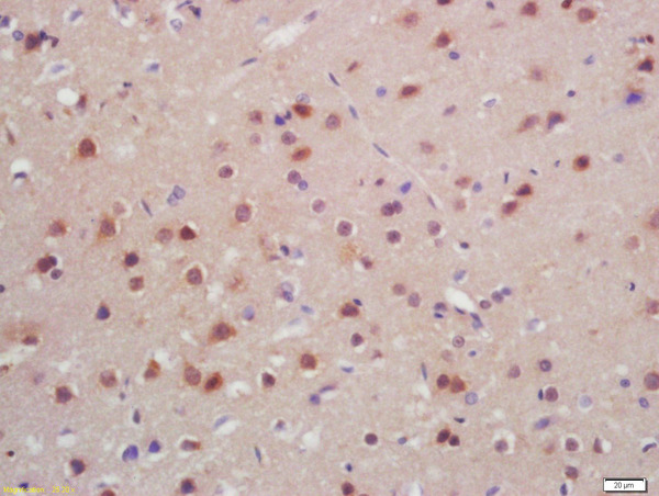 Formalin-fixed and paraffin embedded rat brain labeled with Anti-SATB2 Polyclonal Antibody, Unconjugated (bs-11949R) at 1:200, followed by conjugation to the secondary antibody and DAB staining\n