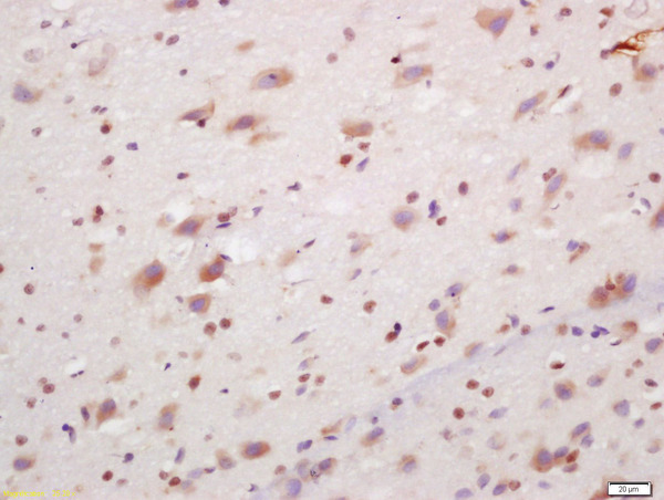 Formalin-fixed and paraffin embedded rat brain labeled with Anti-PCP4/PEP-19 Polyclonal Antibody, Unconjugated (bs-11326R) at 1:200, followed by conjugation to the secondary antibody and DAB staining Formalin-fixed and paraffin embedded rat brain labeled with Anti-PCP4/PEP-19 Polyclonal Antibody, Unconjugated (bs-11326R) at 1:200, followed by conjugation to the secondary antibody and DAB staining
