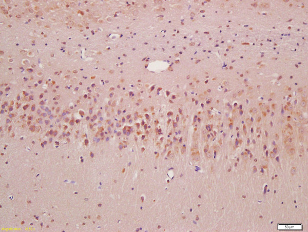 Formalin-fixed and paraffin embedded rat brain labeled with Anti-SQSTM1 Polyclonal Antibody, Unconjugated (bs-2951R) at 1:200, followed by conjugation to the secondary antibody and DAB staining
