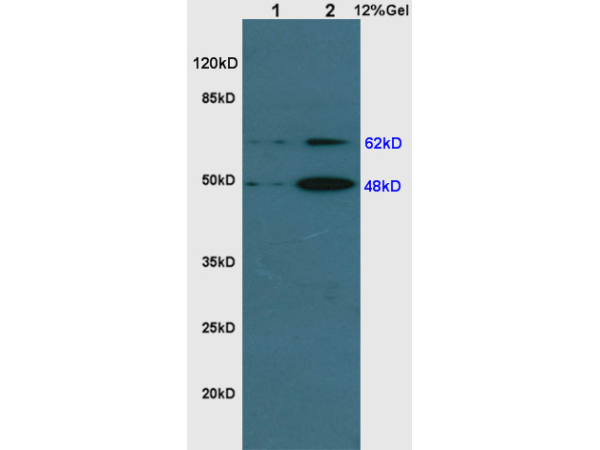 L1 rat kidney lysates, L2 rat brain lysates probed : Anti-GDF9 (bs-2951R) at 1:200 in 4˚C. Followed by conjugation to secondary antibody (bs-0295G-HRP) at 1:3000 90min in 37˚C. Predicted and observed band size: 48kDa and 62kD