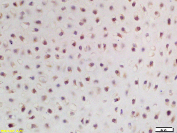 Formalin-fixed and paraffin embedded mouse embryo labeled with Rabbit Anti ZNF268 Polyclonal Antibody, Unconjugated (bs-0627R) at 1:200 followed by conjugation to the secondary antibody and DAB staining