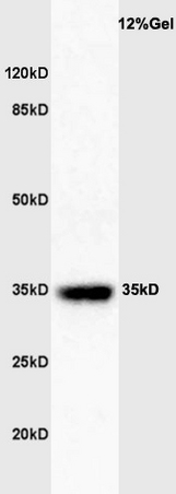 Mouse spleen lysates probed with Rabbit Anti-GATA-1 Polyclonal Antibody (bs-3872R) at 1:200 in 4˚C. Followed by conjugation to secondary antibody (bs-0295G-HRP) at 1:3000 90min in 37˚C. Predicted band size: 35,45kDa and observed band size: 35kDa