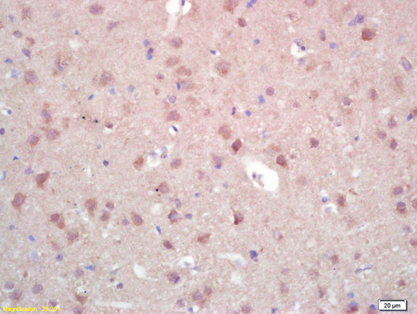 Formalin-fixed and paraffin embedded rat brain labeled with Rabbit Anti ZNF300 Polyclonal Antibody, Unconjugated (bs-0628R) at 1:200 followed by conjugation to the secondary antibody and DAB staining