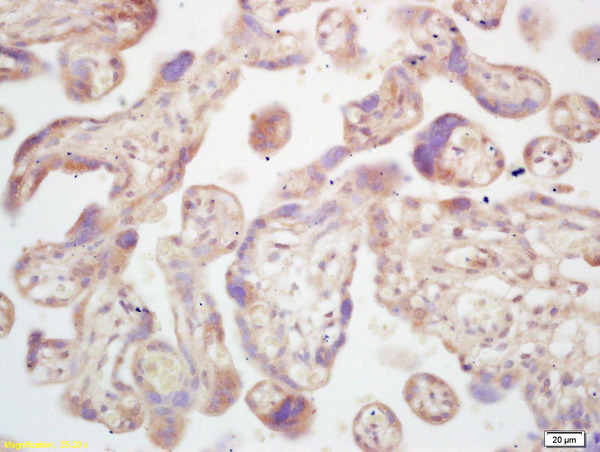 Formalin-fixed and paraffin embedded human placenta labeled with Rabbit Anti SULT1E1/Estrogen Sulfotranferase Polyclonal Antibody, Unconjugated (bs-0629R) at 1:200 followed by conjugation to the secondary antibody and DAB staining