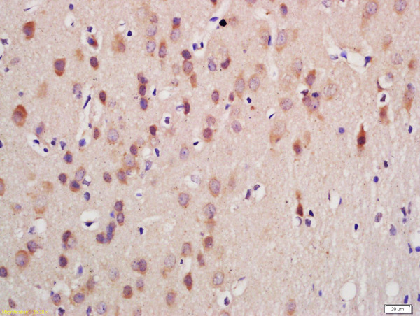 Formalin-fixed and paraffin embedded rat brain labeled with Anti-GnRHR Polyclonal Antibody, Unconjugated (bs-1464R) at 1:200 followed by conjugation to the secondary antibody and DAB staining