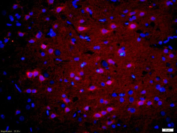Formalin-fixed and paraffin-embedded rat brain labeled with Rabbit Anti-GnRHR Polyclonal Antibody, Unconjugated(bs-1464R) 1:200, overnight at 4°C, The secondary antibody was Goat Anti-Rabbit IgG, Cy3 conjugated(bs-0295G-Cy3)used at 1:200 dilution for 40 minutes at 37°C.