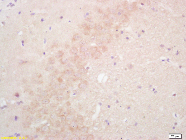 Formalin-fixed and paraffin embedded rat brain labeled with Rabbit Anti SULT1E1/Estrogen Sulfotranferase Polyclonal Antibody, Unconjugated (bs-0629R) at 1:200 followed by conjugation to the secondary antibody and DAB staining