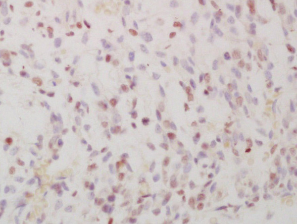 Formalin-fixed and paraffin embedded mouse embryo labeled with Anti-Phospho-FRA1 (Ser265)Polyclonal Antibody, Unconjugated (bs-3158R) at 1:200 followed by conjugation to the secondary antibody and DAB staining