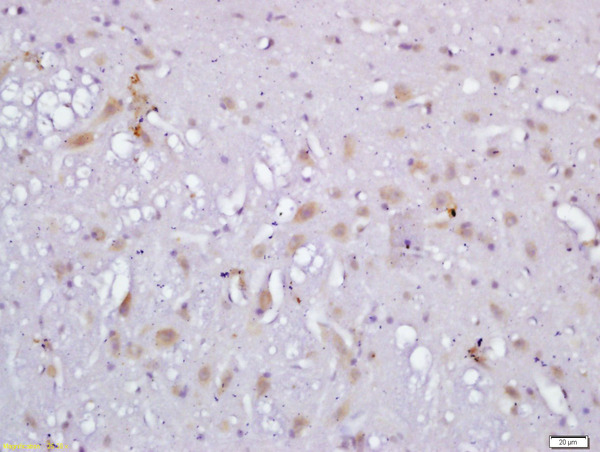 Formalin-fixed and paraffin embedded rat brain labeled with Anti-RLBP1L1 Polyclonal Antibody, Unconjugated (bs-6569R) followed by conjugation to the secondary antibody and DAB staining\n