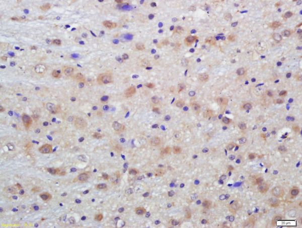 Formalin-fixed and paraffin embedded rat brain labeled with Anti-Phospho-Dab1 (Tyr198)Polyclonal Antibody, Unconjugated (bs-11548R) at 1:200 followed by conjugation to the secondary antibody and DAB staining