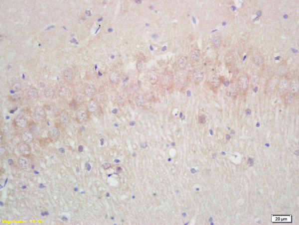 Formalin-fixed and paraffin embedded rat brain labeled with  Rabbit Anti Annexin A13 Polyclonal Antibody, Unconjugated (bs-0634R) at 1:200 followed by conjugation to the secondary antibody and DAB staining