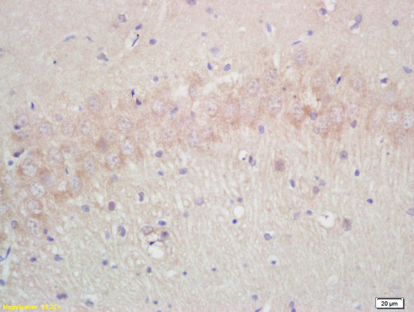 Formalin-fixed and paraffin embedded rat brain labeled with Rabbit Anti Annexin A13 Polyclonal Antibody, Unconjugated (bs-0634R) at 1:200 followed by conjugation to the secondary antibody and DAB staining