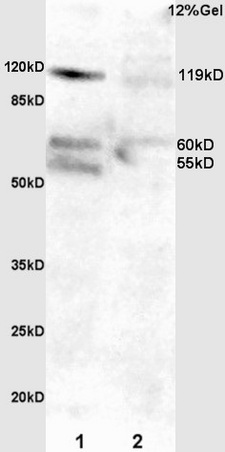 L1 mouse intestine lysate L2 rat lung lysates probed with Anti Phospho-FAK (Tyr397)Polyclonal Antibody, Unconjugated (bs-3159R) at 1:200 overnight at 4˚C. Followed by conjugation to secondary antibody (bs-0295G-HRP) at 1:3000 for 90 min at 37˚C. Predicted band 119kD. Observed band size: 55kD, 60kD, and 119kD