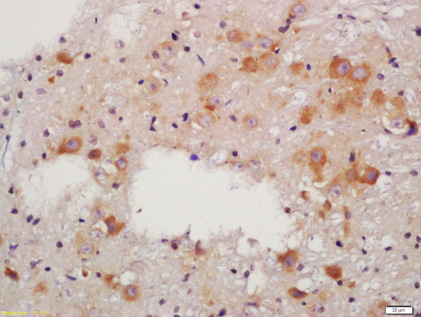 Formalin-fixed and paraffin embedded rat brain labeled with Anti-RALDH2 Polyclonal Antibody, Unconjugated (bs-3676R) at 1:200 followed by conjugation to the secondary antibody and DAB staining